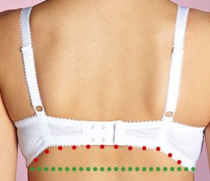 bad bra fitting symptoms