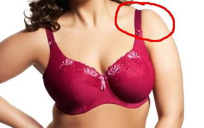 bad bra fitting symptoms