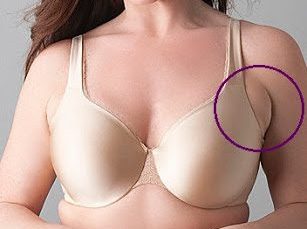 bad bra fitting symptoms